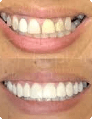 Mask group (21) (1)