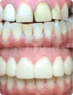 Mask group (23) (1)